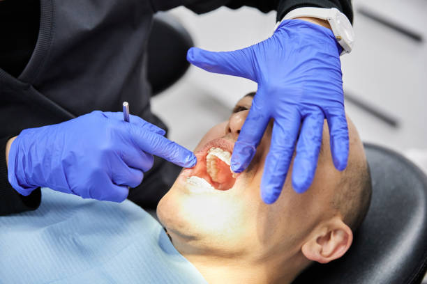 Best Emergency Dentist for Knocked-Out Tooth in , WV